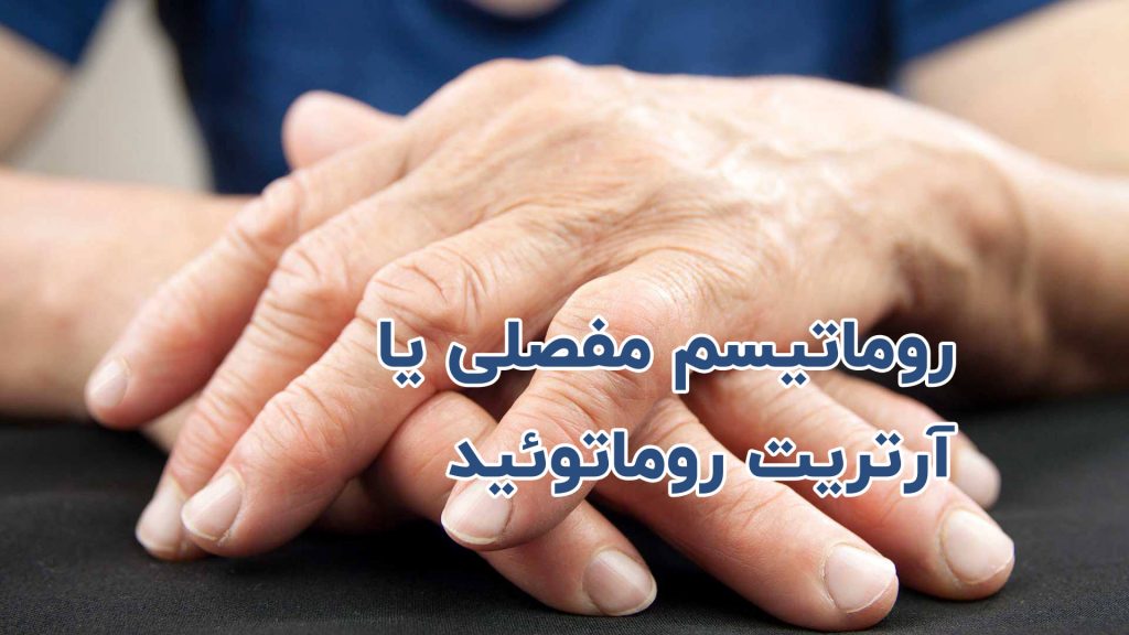 روماتیسم مفصلی یا آرتریت روماتوئید