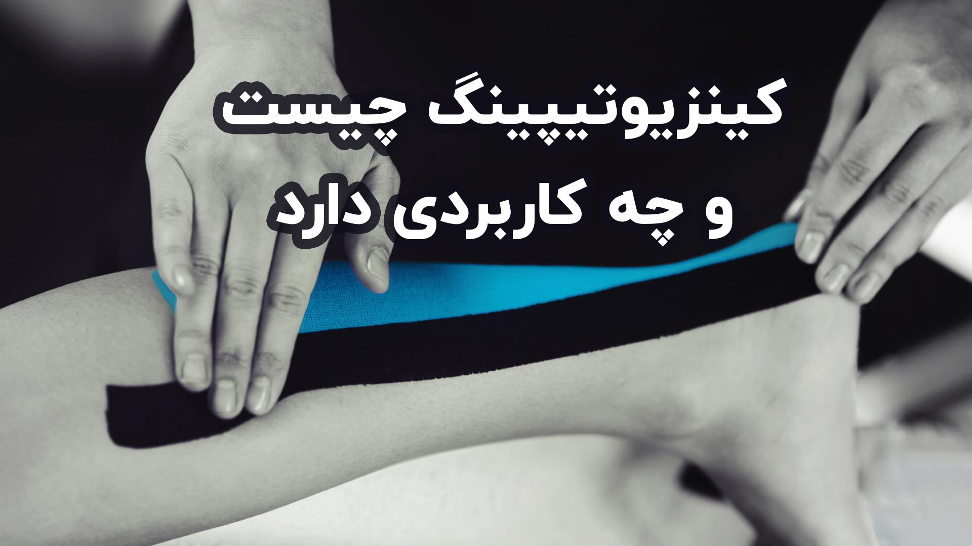 کینزیوتیپینگ