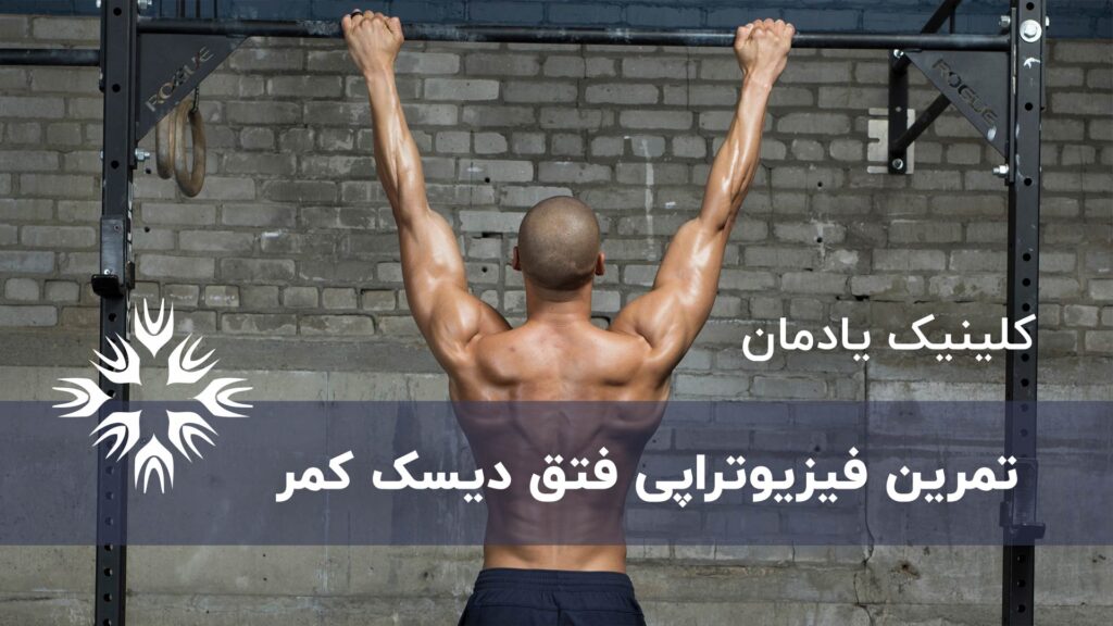 تمرین فیزیوتراپی فتق دیسک کمر