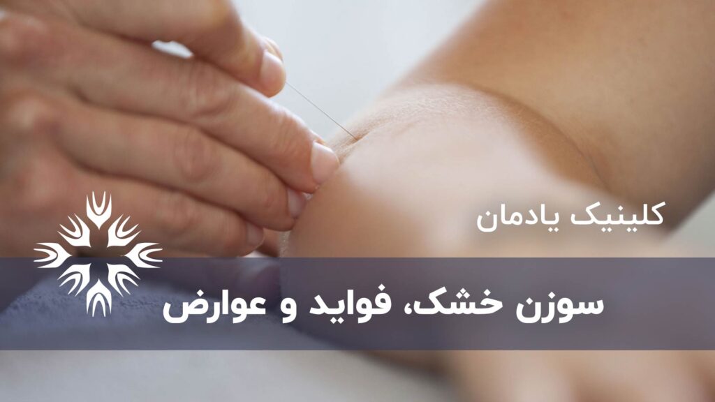 آشنایی با سوزن خشک ، فواید و عوارض