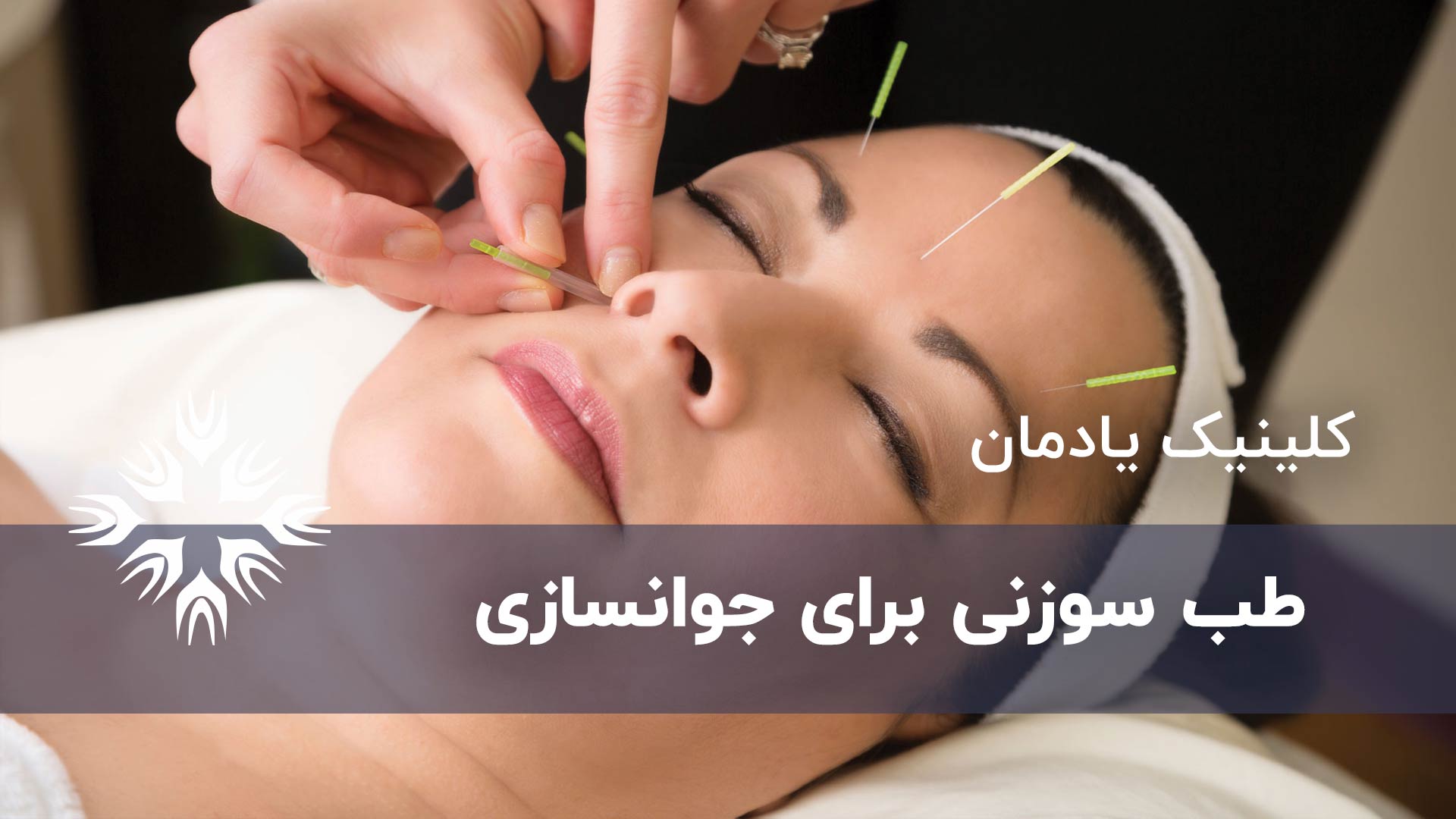 نقش طب سوزنی صورت در جوانسازی