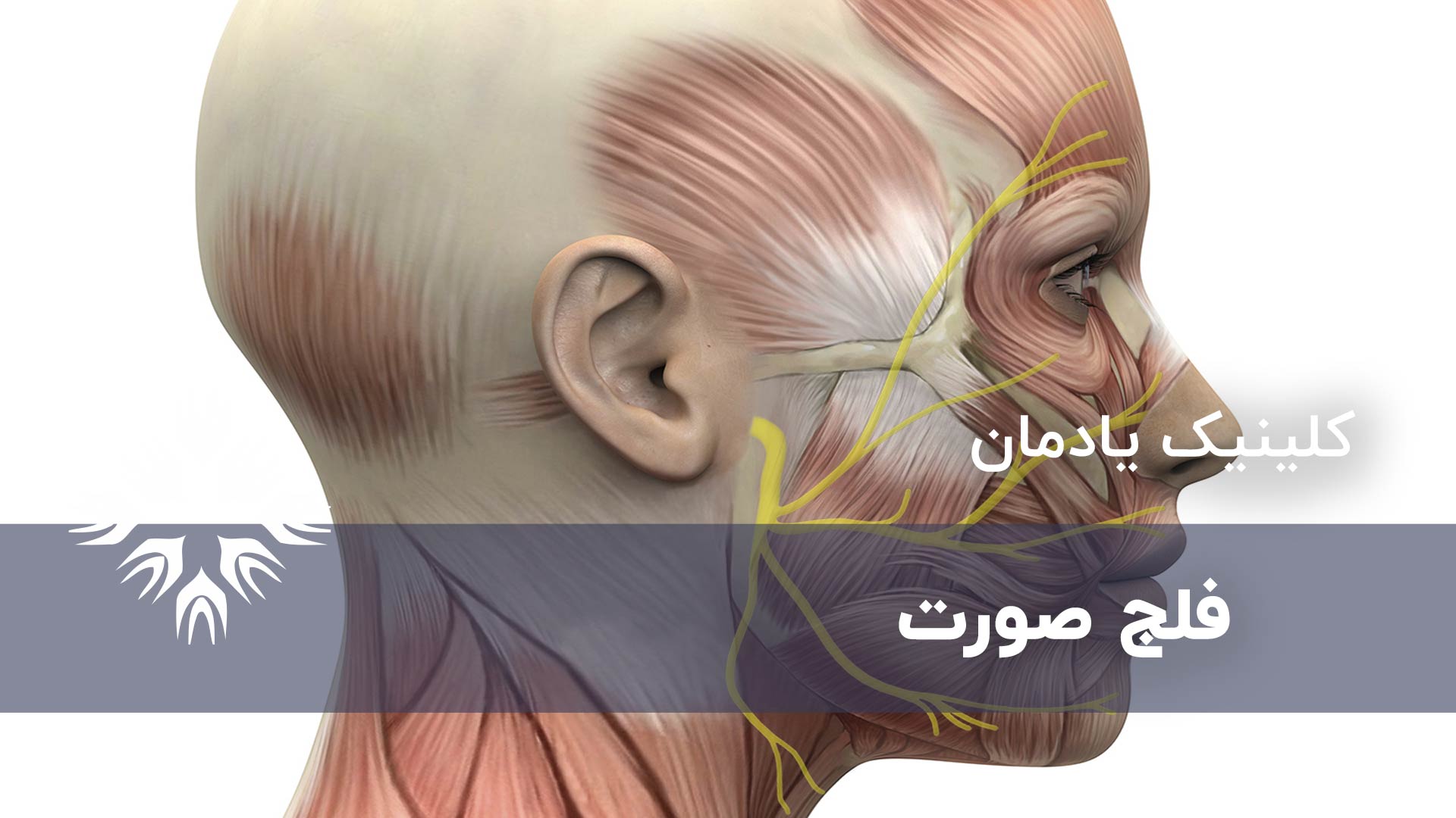 درمان فلج صورت ، سینکینزی و سایر اختلالات