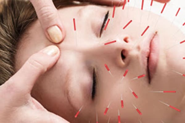 طب سوزنی زیبایی صورت چیست